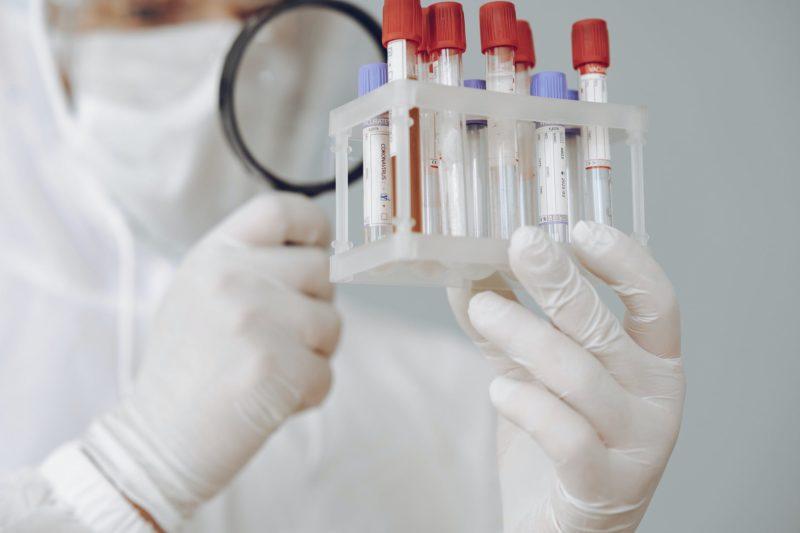 person holding test tube rack