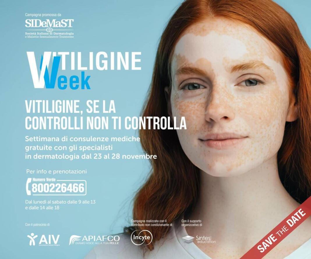 Vitiligine week, Sidemast: “Circa mille consulenze dermatologiche gratuite”